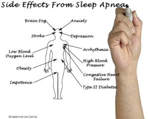 side effects of sleep apnea
